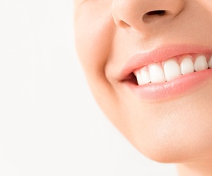 Blanqueamiento Dental